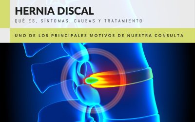 Hernia Discal: qué es, causas, síntomas y tratamiento